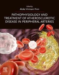 Abbildung von: Pathophysiology and Treatment of Atherosclerotic Disease in Peripheral Arteries - Elsevier