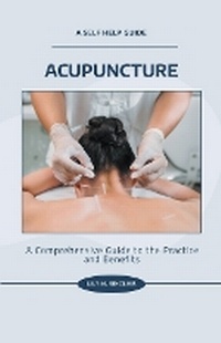 Abbildung von: Acupuncture - Xspurts.com