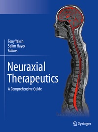 Abbildung von: Neuraxial Therapeutics - Springer