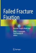 Cover: Failed Fracture Fixation - Springer