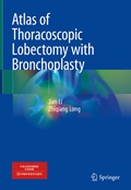 Cover: Atlas of Thoracoscopic Lobectomy with Bronchoplasty - Springer