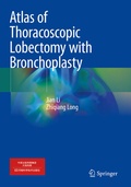 Cover: Atlas of Thoracoscopic Lobectomy with Bronchoplasty - Springer