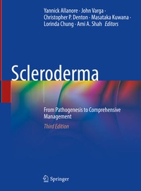 Enlarge image Cover: Scleroderma - Springer