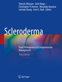 Enlarge image Cover: Scleroderma - Springer