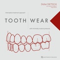 Cover: Tooth Wear - Quintessenz Verlag