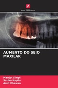 Cover: Aumento Do Seio Maxilar - Edicoes Nosso Conhecimento