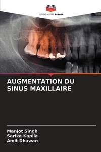 Enlarge image Cover: Augmentation Du Sinus Maxillaire - Editions Notre Savoir