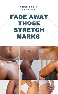 Abbildung von: FADE AWAY THOSE STRETCH MARKS - Lulu.com