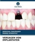 Cover: Versagen Von Implantaten - Verlag Unser Wissen