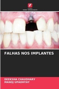 Cover: Falhas Nos Implantes - Edicoes Nosso Conhecimento