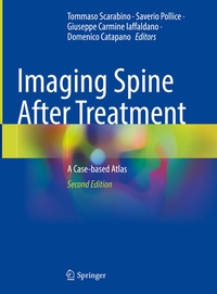 Abbildung von: Imaging Spine After Treatment - Springer