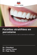 Cover: Facettes stratifiees en porcelaine - Editions Notre Savoir
