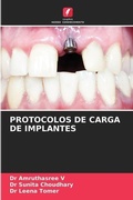 Cover: Protocolos de Carga de Implantes - Edicoes Nosso Conhecimento