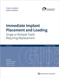 Cover: Immediate Implant Placement and Loading - Single or Multiple Teeth Requiring Replacement - Quintessence Publishing Co. Ltd.