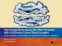 Abbildung von: The Human Brain during the Third Trimester 260- to 270-mm Crown-Rump Lengths - CRC Press