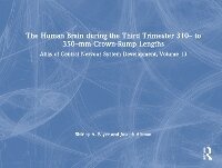 Abbildung von: The Human Brain during the Third Trimester 310- to 350-mm Crown-Rump Lengths - CRC Press