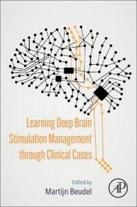 Abbildung von: Learning Deep Brain Stimulation Management through Clinical Cases - Academic Press