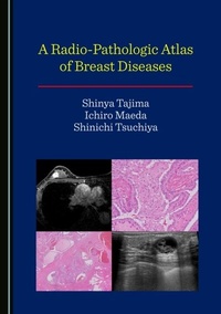 Abbildung von: Radio-Pathologic Atlas of Breast Diseases - Cambridge Scholars Publishing