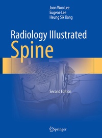 Bild: Radiology Illustrated: Spine - Springer