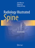 Cover: Radiology Illustrated: Spine - Springer