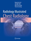 Cover: Radiology Illustrated: Chest Radiology - Springer