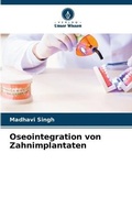 Cover: Oseointegration von Zahnimplantaten - Verlag Unser Wissen