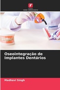 Cover: Oseointegracao de Implantes Dentarios - Edicoes Nosso Conhecimento