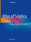 Cover: Atlas of Sciatica - Springer