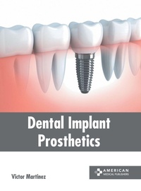 Abbildung von: Dental Implant Prosthetics - American Medical Publishers