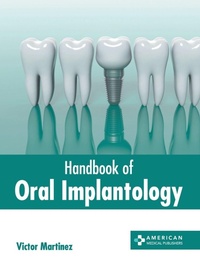 Abbildung von: Handbook of Oral Implantology - American Medical Publishers