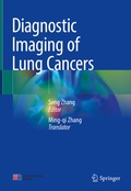 Cover: Diagnostic Imaging of Lung Cancers - Springer