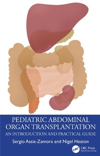 Abbildung von: Pediatric Abdominal Organ Transplantation - Taylor & Francis