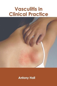 Enlarge image Cover: Vasculitis in Clinical Practice - HAYLE MEDICAL