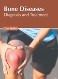 Cover: Bone Diseases: Diagnosis and Treatment - American Medical Publishers