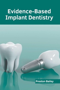 Abbildung von: Evidence-Based Implant Dentistry - American Medical Publishers