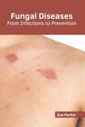 Cover: Fungal Diseases: From Infections to Prevention - American Medical Publishers