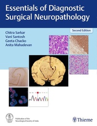 Bild: Essentials of Diagnostic Surgical Neuropathology - Thieme Publishers