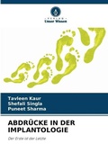 Cover: Abdruecke in Der Implantologie - Verlag Unser Wissen