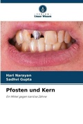 Cover: Pfosten und Kern - Verlag Unser Wissen