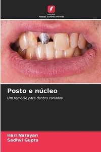 Enlarge image Cover: Posto e nucleo - Edicoes Nosso Conhecimento