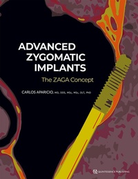 Abbildung von: Advanced Zygomatic Implants - Quintessence Publishing Co, Inc