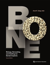 Abbildung von: Bone - Quintessence Publishing Co, Inc
