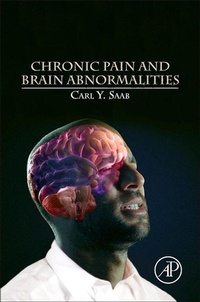 Enlarge image Cover: Chronic Pain and Brain Abnormalities - Academic Press