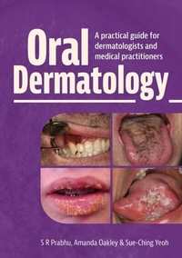 Abbildung von: Oral Dermatology - Scion Publishing
