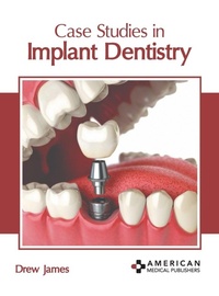 Abbildung von: Case Studies in Implant Dentistry - American Medical Publishers