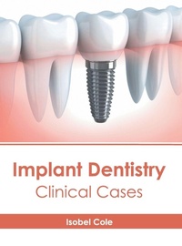 Abbildung von: Implant Dentistry: Clinical Cases - American Medical Publishers