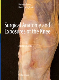 Abbildung von: Surgical Anatomy and Exposures of the Knee - Springer