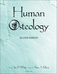 Abbildung von: Human Osteology - Academic Press