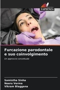 Cover: Furcazione parodontale e suo coinvolgimento - Edizioni Sapienza