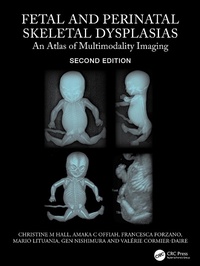 Abbildung von: Fetal and Perinatal Skeletal Dysplasias - CRC Press